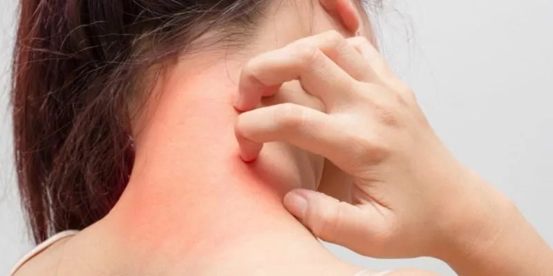 vi sinh phát triển dị ứng