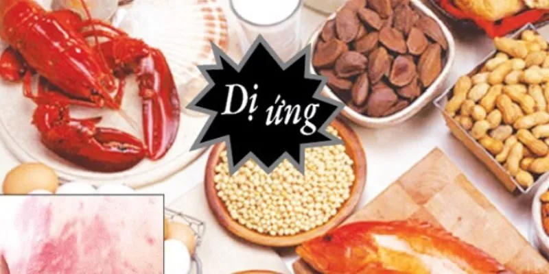 Dị ứng và không dung nạp thực phẩm – sự khác biệt và tương đồng