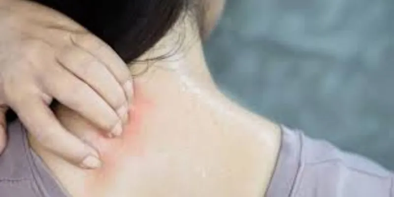 vi sinh phát triển dị ứng