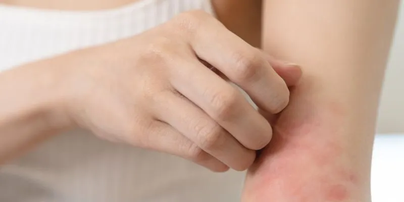 vi sinh phát triển dị ứng